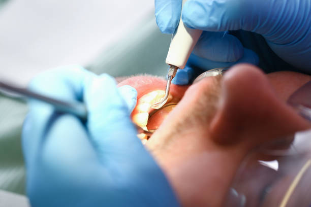 Best Emergency Treatment for Toothache in Lovington, NM